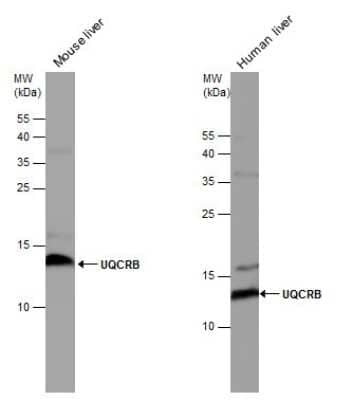 Western Blot: UQCRB Antibody [NBP3-12970] - UQCRB antibody detects UQCRB protein by western blot analysis. Human tissue extracts (30 ug) and mouse tissue extracts (50 ug) were separated by 15% SDS-PAGE, and the membrane was blotted with UQCRB antibody (NBP3-12970) diluted at 1:5000.