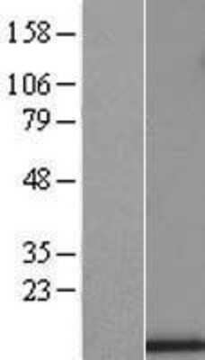 Western Blot: UQCRB Overexpression Lysate (Adult Normal) [NBL1-17628] Left-Empty vector transfected control cell lysate (HEK293 cell lysate); Right -Over-expression Lysate for UQCRB.