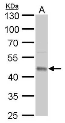 Western Blot: UQCRC1 Antibody (1311) [NBP2-43596] - Analysis of A. 50 ug mouse brain lysate/extract 10 % SDS-PAGE UQCRC1 antibody [1311] dilution: 1:1000