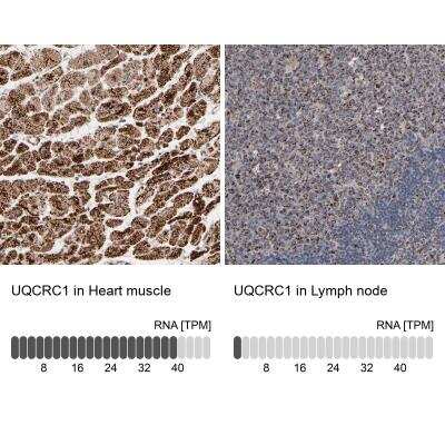 <b>Independent Antibodies Validation and Orthogonal Strategies Validation.</b>Immunohistochemistry-Paraffin: UQCRC1 Antibody [NBP1-85328] - Staining in human heart muscle and lymph node tissues using anti-UQCRC1 antibody. Corresponding UQCRC1 RNA-seq data are presented for the same tissues.