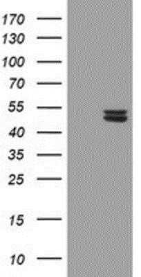 Western Blot: UQCRC1 Antibody (OTI1G6) [NBP2-03825] - HEK293T cells were transfected with the pCMV6-ENTRY control (Left lane) or pCMV6-ENTRY UQCRC1 (Right lane) cDNA for 48 hrs and lysed. Equivalent amounts of cell lysates (5 ug per lane) were separated by SDS-PAGE and immunoblotted with anti-UQCRC1.