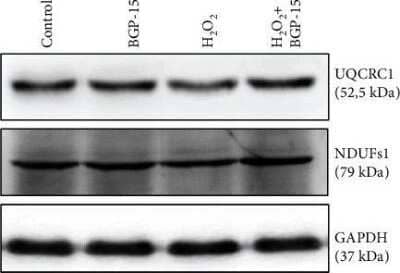 Western Blot: UQCRC1 Antibody (OTI1G6) [NBP2-03825] - Effect of BGP-15 treatment on the electron transport chain complex I and III proteins in NRCMs. Western blot analysis of UQCRC1 (NBP2-03825) and Ndufs1 (NBP1-31142) proteins is shown. GAPDH was used as a loading control. Control group: cells without any treatment; BGP-15 group: cells with only 50uM BGP-15 for 0.5 hours; H2O2group: cells with 150uM H2O2for 0.5 hours; H2O2+BGP-15 group: cells with 150uM H2O2and 50uM BGP-15 for 0.5 hours.Image collected and cropped by CiteAb from the following publication (//pubmed.ncbi.nlm.nih.gov/33728024/) licensed under a CC-BY license.