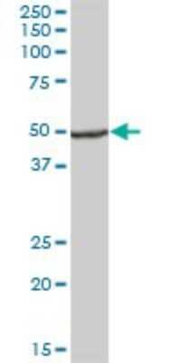 Western Blot: UQCRC1 Antibody [H00007384-B01P] - Analysis of UQCRC1 expression in human spleen.