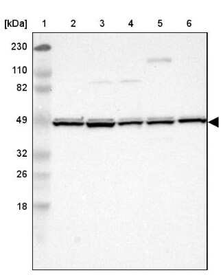 Western Blot: UQCRC1 Antibody [NBP1-85328] - Lane 1: Marker  [kDa] 230, 110, 82, 49, 32, 26, 18.   Lane 2: Human cell line RT-4.  Lane 3: Human cell line U-251MG sp.  Lane 4: Human cell line A-431.  Lane 5: Human liver tissue.  Lane 6: Human tonsil tissue