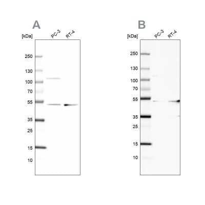 Western Blot: UQCRC1 Antibody [NBP1-85328] - Analysis using Anti-UQCRC1 antibody NBP1-85328 (A) shows similar pattern to independent antibody NBP1-85329 (B).