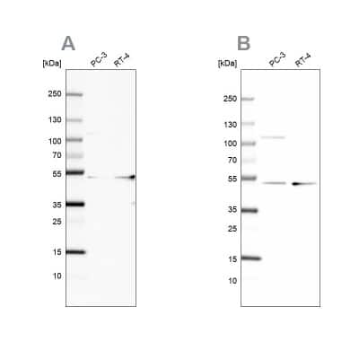 Western Blot UQCRC1 Antibody