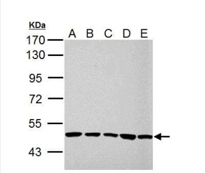 Western Blot: UQCRC1 Antibody [NBP2-20815] - A. 30 ug 293T whole cell lysate/extractB. 30 ug A431 whole cell lysate/extract C. 30 ug HeLa whole cell lysate/extractD. 30 ug HepG2 whole cell lysate/extract E. 30 ug A375 whole cell lysate/extract10 % SDS-PAGE UQCRC1 antibody dilution: 1:10000