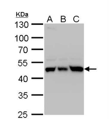 Western Blot: UQCRC1 Antibody [NBP2-20815] - A Huh7 whole cell lysate/extract B Hep3B whole cell lysate/extract C HepG2 whole cell lysate/extract 10 % SDS-PAGE UQCRC1 antibody dilution: 1:5000