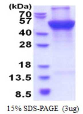 SDS-PAGE Recombinant Human UQCRC1 His Protein