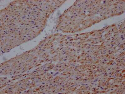 Immunohistochemistry: UQCRC2 Antibody (2F6) [NBP3-15182] - IHC image of UQCRC2 antibody diluted at 1:100 and staining in paraffin-embedded human heart tissue. After dewaxing and hydration, antigen retrieval was mediated by high pressure in a citrate buffer (pH 6.0). Section was blocked with 10% normal goat serum 30 minutes at RT. Then primary antibody (1% BSA) was incubated at 4C overnight. The primary is detected by a Goat anti-rabbit IgG polymer labeled by HRP and visualized using 0.05% DAB.