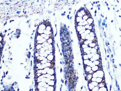 Immunohistochemistry-Paraffin: UQCRC2 Antibody (3E3O8) [NBP3-16390] - Immunohistochemistry of paraffin-embedded human colon using UQCRC2 Rabbit mAb (NBP3-16390) at dilution of 1:100 (40x lens).Perform microwave antigen retrieval with 10 mM PBS buffer pH 7.2 before commencing with IHC staining protocol.