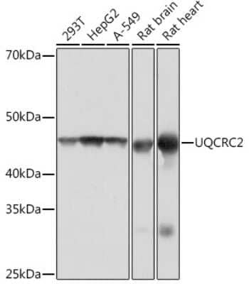 Western Blot: UQCRC2 Antibody (3E3O8) [NBP3-16390] - Western blot analysis of extracts of various cell lines, using UQCRC2 Rabbit mAb (NBP3-16390) at 1:1000 dilution. Secondary antibody: HRP Goat Anti-Rabbit IgG (H+L) at 1:10000 dilution. Lysates/proteins: 25ug per lane. Blocking buffer: 3% nonfat dry milk in TBST. Detection: ECL Basic Kit. Exposure time: 1s.