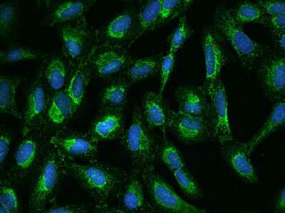 Immunocytochemistry/Immunofluorescence: UQCRC2 Antibody [NBP2-97364] - Immunofluorescence staining of UQCRC2 in U2OS cells. Cells were fixed with 4% PFA, permeabilzed with 0.1% Triton X-100 in PBS, blocked with 10% serum, and incubated with rabbit anti-Human UQCRC2 polyclonal antibody (dilution ratio 1:100) at 4C overnight. Then cells were stained with the Alexa Fluor(R)488-conjugated Goat Anti-rabbit IgG secondary antibody (green) and counterstained with DAPI (blue).Positive staining was localized to Cytoplasm.