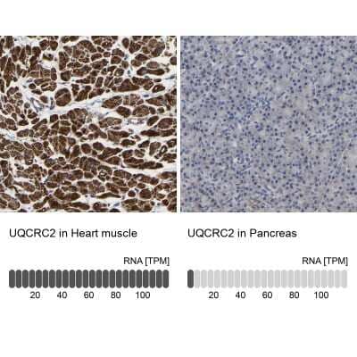 Immunohistochemistry-Paraffin: UQCRC2 Antibody [NBP1-80861] - Staining in human heart muscle and pancreas tissues using anti-UQCRC2 antibody. Corresponding UQCRC2 RNA-seq data are presented for the same tissues.