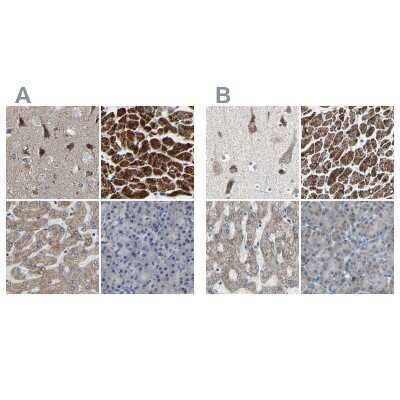 Immunohistochemistry-Paraffin: UQCRC2 Antibody [NBP1-80861] - Staining of human cerebral cortex, heart muscle, liver and pancreas using Anti-UQCRC2 antibody NBP1-80861 (A) shows similar protein distribution across tissues to independent antibody NBP1-80862 (B).