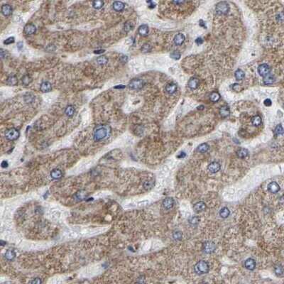 Immunohistochemistry-Paraffin: UQCRC2 Antibody [NBP1-80861] - Staining of human liver.