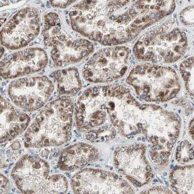 Immunohistochemistry-Paraffin: UQCRC2 Antibody [NBP1-80862] - Staining of human kidney shows distinct cytoplasmic positivity with granular pattern in tubule cells.