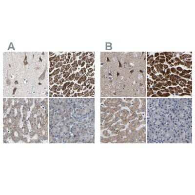 <b>Independent Antibodies Validation. </b>Immunohistochemistry-Paraffin: UQCRC2 Antibody [NBP1-80862] - Staining of human cerebral cortex, heart muscle, liver and pancreas using Anti-UQCRC2 antibody NBP1-80862 (A) shows similar protein distribution across tissues to independent antibody NBP1-80861 (B).