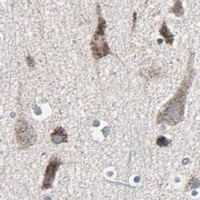 Immunohistochemistry-Paraffin: UQCRC2 Antibody [NBP1-80862] - Staining of human cerebral cortex.