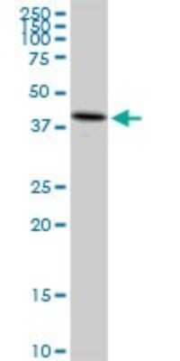 Western Blot: UQCRC2 Antibody [H00007385-D01P] - Analysis of UQCRC2 expression in human colon.