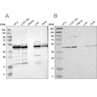 Western Blot: UQCRC2 Antibody [NBP1-80861] - Analysis using Anti-UQCRC2 antibody NBP1-80861 (A) shows similar pattern to independent antibody NBP1-80862 (B).