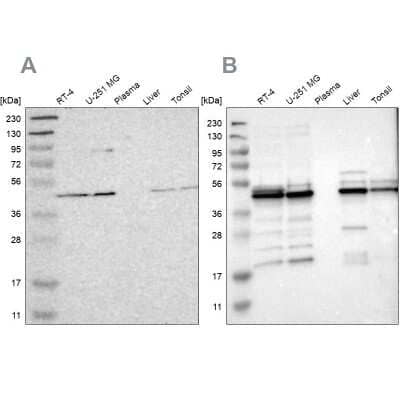 Western Blot: UQCRC2 Antibody [NBP1-80862] - Analysis using Anti-UQCRC2 antibody NBP1-80862 (A) shows similar pattern to independent antibody NBP1-80861 (B).