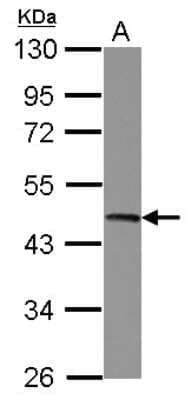 Western Blot: UQCRC2 Antibody [NBP2-20816] - Sample (30 ug of whole cell lysate) A: Jurkat 10% SDS PAGE gel, diluted at 1:10000.