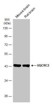 Western Blot: UQCRC2 Antibody [NBP2-20816] - Various tissue extracts (50 ug) were separated by 10% SDS-PAGE, and the membrane was blotted with UQCRC2 antibody diluted at 1:10000. HRP-conjugated anti-rabbit IgG antibody was used to detect the primary antibody.