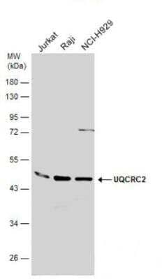 Western Blot: UQCRC2 Antibody [NBP2-20816] - Various whole cell extracts (30 ug) were separated by 10% SDS-PAGE, and the membranes were blotted with UQCRC2 antibody diluted at 1:10000. The HRP-conjugated anti-rabbit IgG antibody was used to detect the primary antibody.