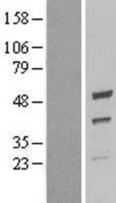 Western Blot: UQCRC2 Overexpression Lysate (Adult Normal) [NBL1-17630] Left-Empty vector transfected control cell lysate (HEK293 cell lysate); Right -Over-expression Lysate for UQCRC2.