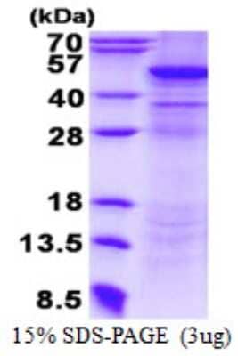 SDS-Page: UQCRC2 Protein [NBP2-22916]