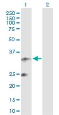 Western Blot: UQCRFS1 Antibody [H00007386-D01P] - Analysis of UQCRFS1 expression in transfected 293T cell line by UQCRFS1 polyclonal antibody.Lane 1: UQCRFS1 transfected lysate(29.70 KDa).Lane 2: Non-transfected lysate.
