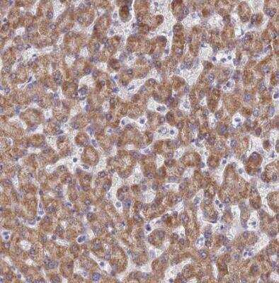 Immunohistochemistry-Paraffin: UQCRH Antibody [NBP1-93442] - Staining of human liver shows moderate granular cytoplasmic positivity in hepatocytes.