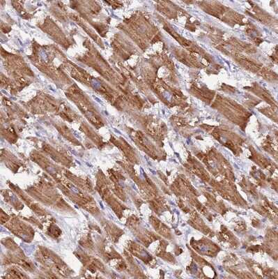 Immunohistochemistry-Paraffin UQCRQ Antibody