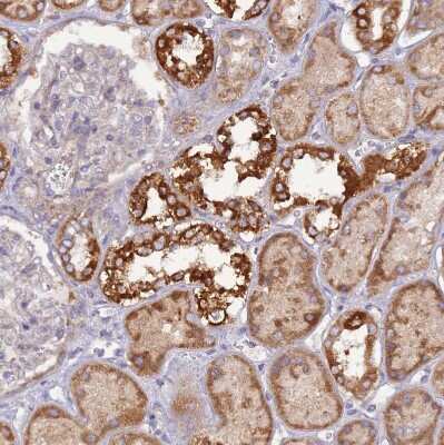 Immunohistochemistry-Paraffin UQCRQ Antibody