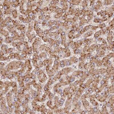 Immunohistochemistry-Paraffin: UQCRQ Antibody [NBP1-92563] - Staining of human liver shows strong granular cytoplasmic positivity in hepatocytes.