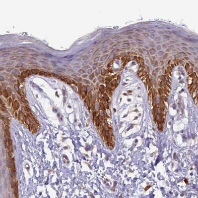 Immunohistochemistry-Paraffin: UQCRQ Antibody [NBP1-92563] - Staining of human skin shows moderate to strong granular cytoplasmic positivity in squamous epithelial cells.