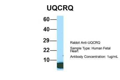 Western Blot: UQCRQ Antibody [NBP2-86043] - Host: Rabbit. Target Name: UQCRQ. Sample Type: Human Fetal Heart. Antibody Dilution: 1.0ug/ml