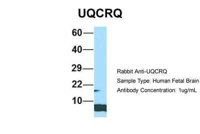 Western Blot: UQCRQ Antibody [NBP2-86043] - Host: Rabbit. Target Name: UQCRQ. Sample Type: Human Fetal Brain. Antibody Dilution: 1.0ug/ml