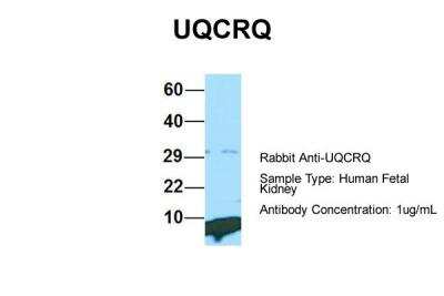 Western Blot: UQCRQ Antibody [NBP2-86043] - Host: Rabbit. Target Name: UQCRQ. Sample Type: Human Fetal Kidney. Antibody Dilution: 1.0ug/ml