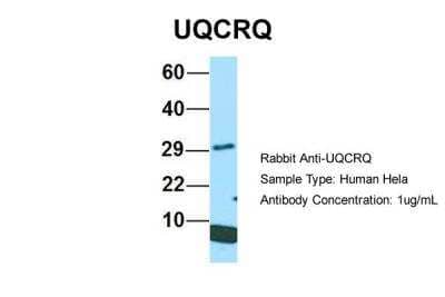 Western Blot: UQCRQ Antibody [NBP2-86043] - Host: Rabbit. Target Name: UQCRQ. Sample Type: Human Hela. Antibody Dilution: 1.0ug/mlUQCRQ is supported by BioGPS gene expression data to be expressed in HeLa