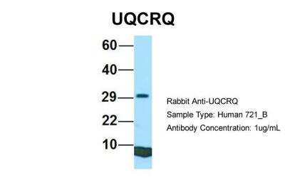 Western Blot: UQCRQ Antibody [NBP2-86043] - Host: Rabbit. Target Name: UQCRQ. Sample Type: Human 721_B. Antibody Dilution: 1.0ug/mlUQCRQ is supported by BioGPS gene expression data to be expressed in 721_B