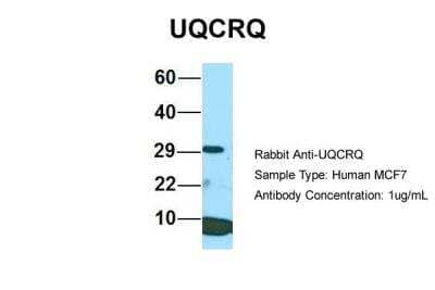 Western Blot: UQCRQ Antibody [NBP2-86043] - Host: Rabbit. Target Name: UQCRQ. Sample Type: Human MCF7. Antibody Dilution: 1.0ug/mlUQCRQ is supported by BioGPS gene expression data to be expressed in MCF7