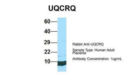 Western Blot: UQCRQ Antibody [NBP2-86043] - Host: Rabbit. Target Name: UQCRQ. Sample Type: Human Adult Placenta. Antibody Dilution: 1.0ug/ml