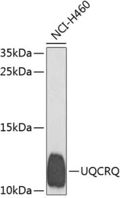 Western Blot: UQCRQ Antibody [NBP2-93506] - Analysis of extracts of H460 cells, using UQCRQ at 1:1000 dilution.Secondary antibody: HRP Goat Anti-Rabbit IgG (H+L) at 1:10000 dilution.Lysates/proteins: 25ug per lane.Blocking buffer: 3% nonfat dry milk in TBST.Detection: ECL Basic Kit .Exposure time: