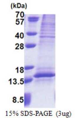 SDS-PAGE Recombinant Human UQCRQ His Protein