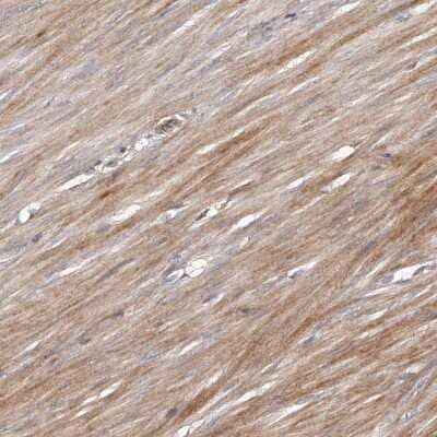 Immunohistochemistry-Paraffin: URG4 Antibody [NBP1-87983] - Staining of human smooth muscle shows cytoplasmic positivity in smooth muscle cells.