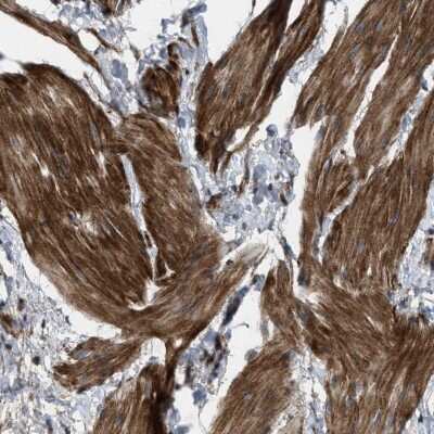 Immunohistochemistry-Paraffin: URG4 Antibody [NBP1-87984] - Staining of human smooth muscle shows cytoplasmic positivity in smooth muscle cells.