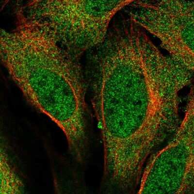 Immunocytochemistry/Immunofluorescence: URI Antibody [NBP2-57701] - Staining of human cell line U-2 OS shows localization to nucleoplasm & cytosol.