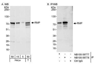 Western Blot: URI Antibody [NB100-59777] - Detection of Human RMP on HeLa whole cell lysate using NB100-59777. RMP was also immunoprecipitated by rabbit anti-RMP antibody NB100-59778.